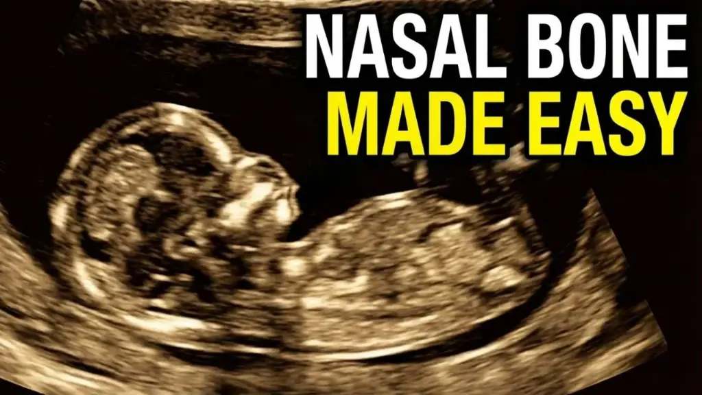 Fetal Aneuploidy Screening Mastery